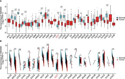 Transmembrane protein 88 suppresses hepatocellular carcinoma progression and serves as a novel prognostic factor